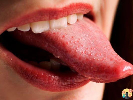 ¿Remedios para la lengua quemada?