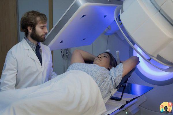 ¿Cuándo hacer radioterapia después de una prostatectomía radical?