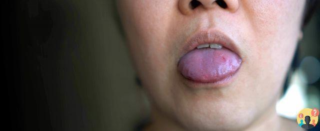 ¿Qué significa cuando te muerdes la lengua?