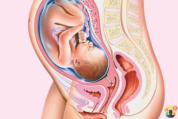 ¿Qué es el cerclaje en el embarazo?