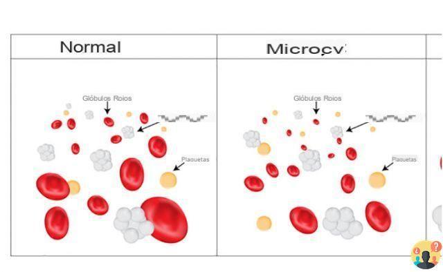 ¿Qué es la microcitosis?