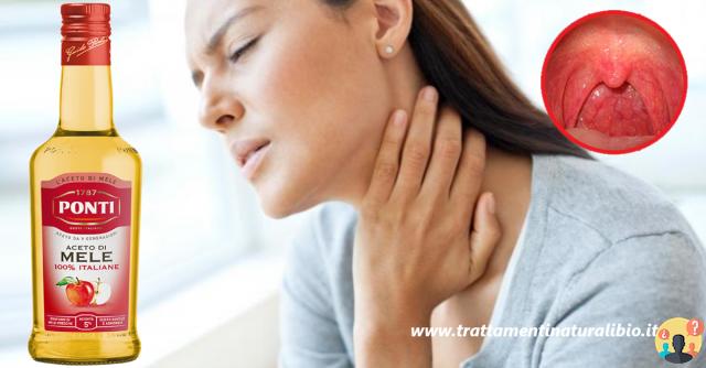 ¿Cómo curar un dolor de garganta en un día?