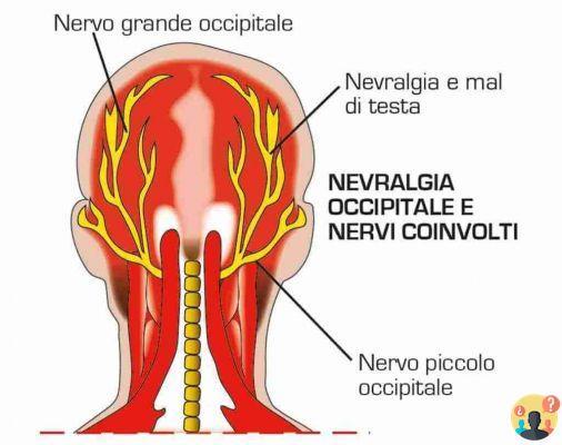 ¿Qué es el área occipital de la cabeza?