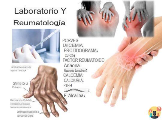 ¿Exámenes para la artritis reumatoide?