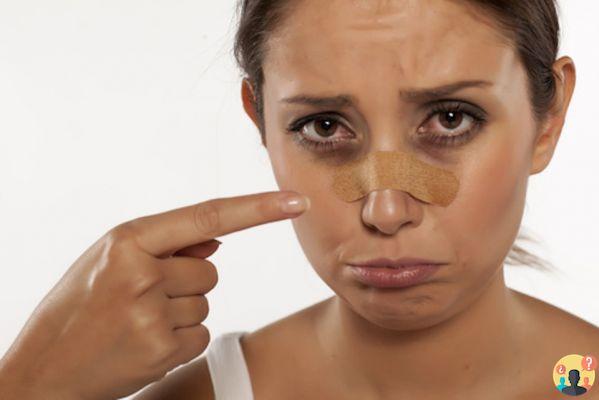 ¿Cómo desinflamar la nariz después de un golpe?