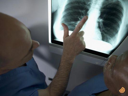 Embolia pulmonar cuando sana?