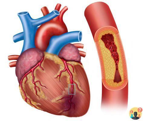 ¿Cuántas coronarias tiene el corazón humano?