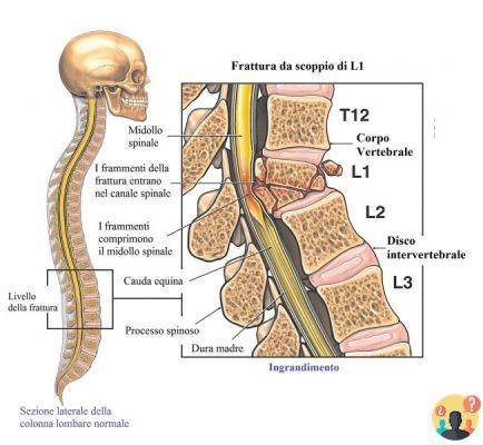 ¿Qué es la vértebra l1?