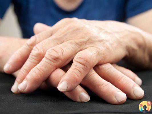 ¿Cómo curar la artritis seronegativa qué medicamentos?