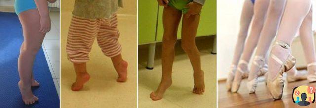 ¿Por qué los niños caminan con los dedos de los pies?