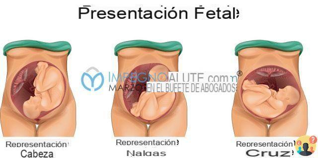 ¿Cómo saber si el feto está en posición cefálica?