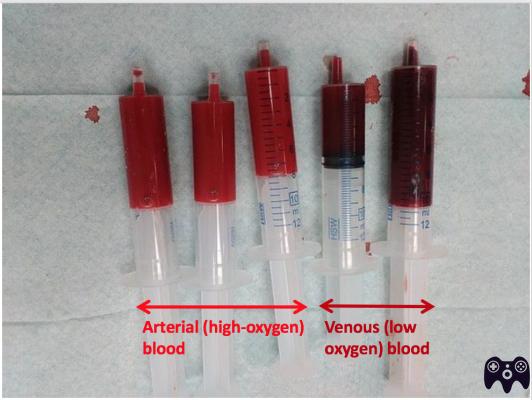 ¿Cuál es la diferencia entre sangre venosa y arterial?