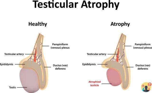 ¿Cura para la hipotrofia testicular?