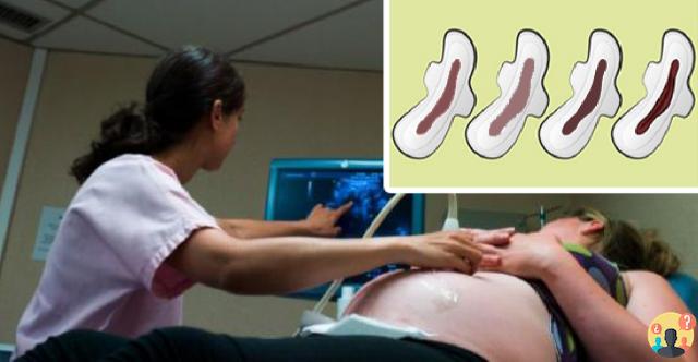 ¿Mucosidad filamentosa marrón en el embarazo?