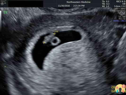 ¿Cuándo es visible el embrión por ultrasonido?