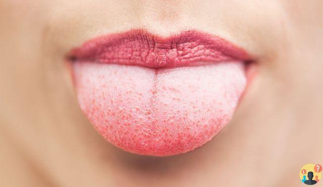 ¿Qué significa lengua protuberante?