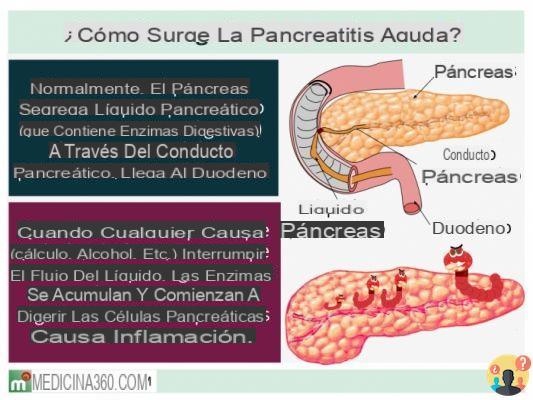 ¿Qué es la pancreatitis fulminante?