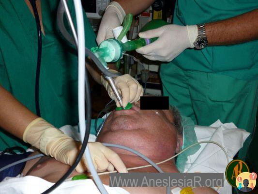 ¿Anestesia general con intubación?