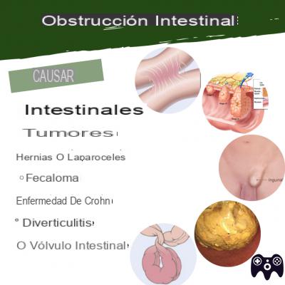 ¿Obstrucción intestinal cuántos días?
