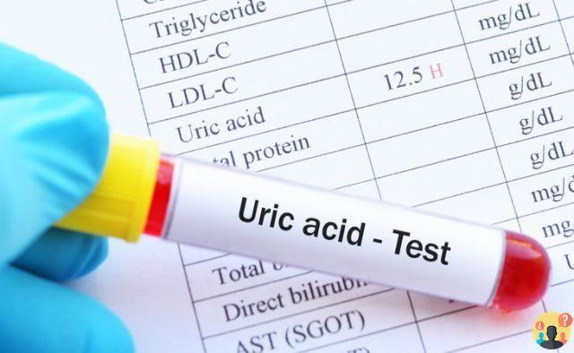 ¿Qué es la uricemia por ácido úrico?