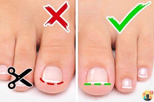 ¿Cómo se deben cortar las uñas de los pies?