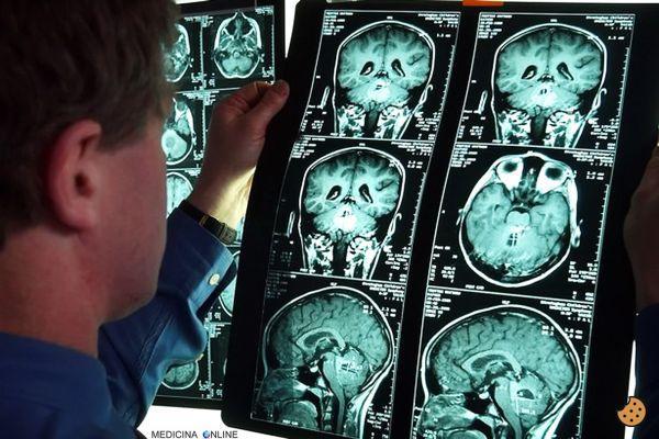 ¿Cuánto dura la anoxia cerebral?