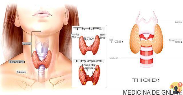 ¿Diferencia entre tiroiditis de hashimoto e hipotiroidismo?