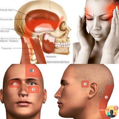 ¿Cuánto tiempo puede durar un dolor de cabeza tensional?