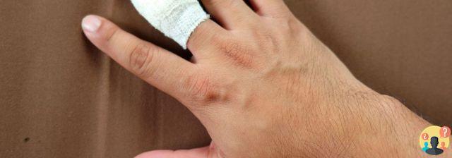¿Cuánto dura un dedo embolsado?