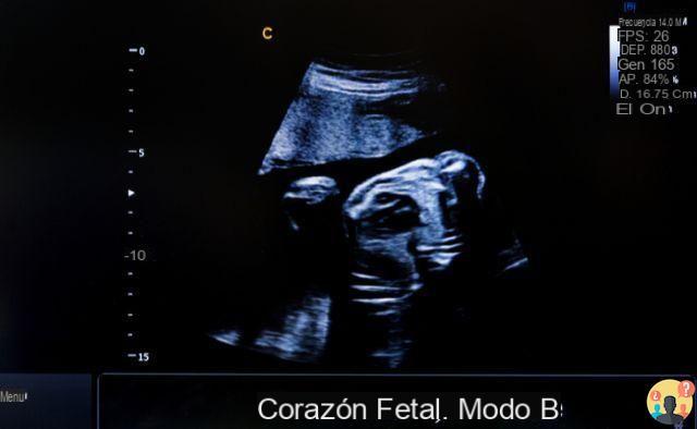 ¿Ecocardiografía fetal y cuánto cuesta?