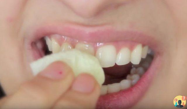 ¿Cómo se quitan las manchas de los dientes?