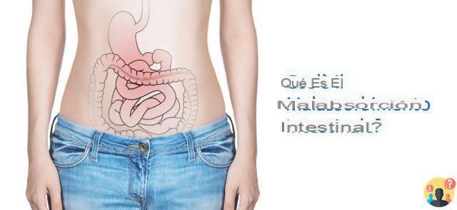¿Qué es la malabsorción intestinal?
