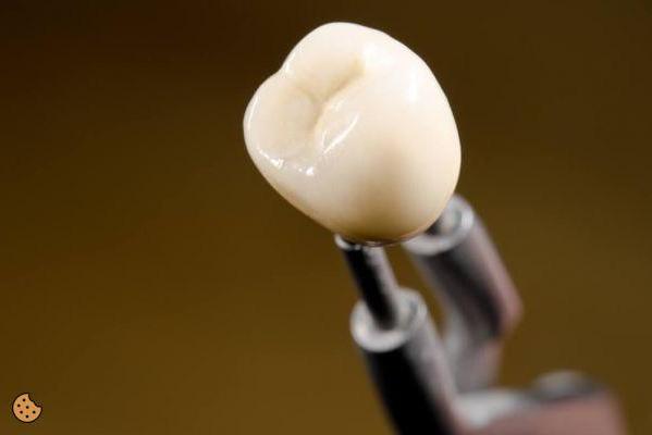 ¿Cuánto cuesta la cápsula dental?