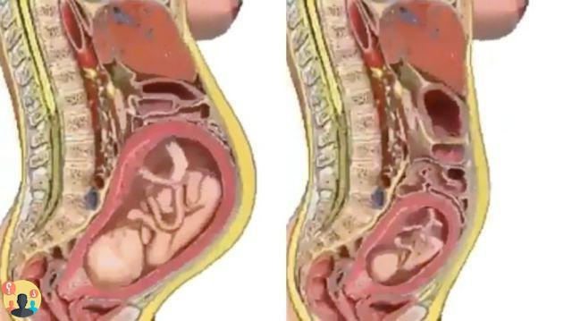 ¿Cómo se colocan los órganos en el embarazo?