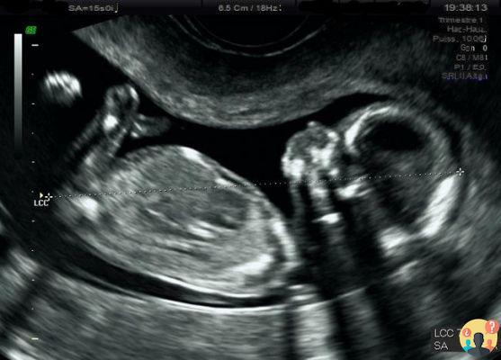 15 semanas de embarazo ¿movimientos?