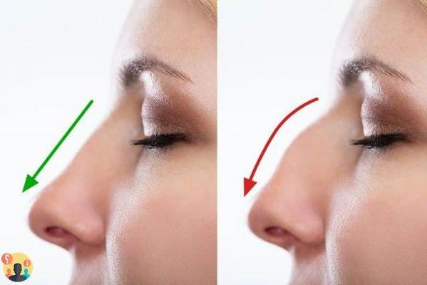 ¿Cuánto cuesta operarse la nariz?