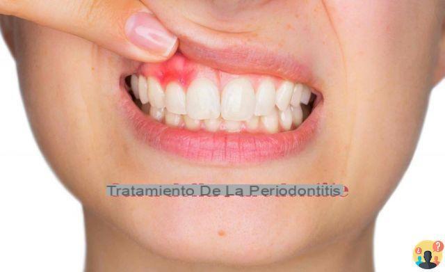 ¿Qué es la periodontosis?