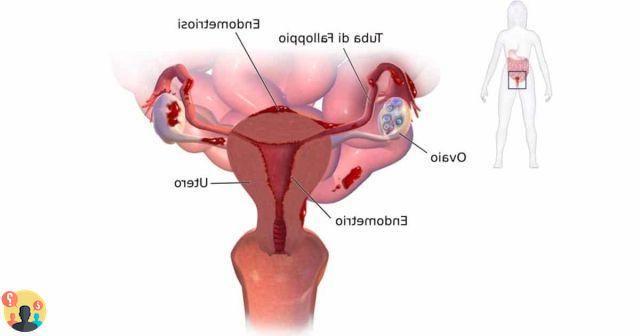 endometrio secretor despues de cuanto tiempo te viene la regla?